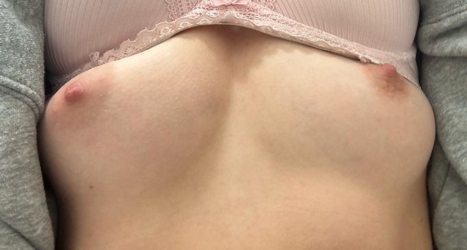 New Nudes From Miss4ever18 — Image 10 of 12